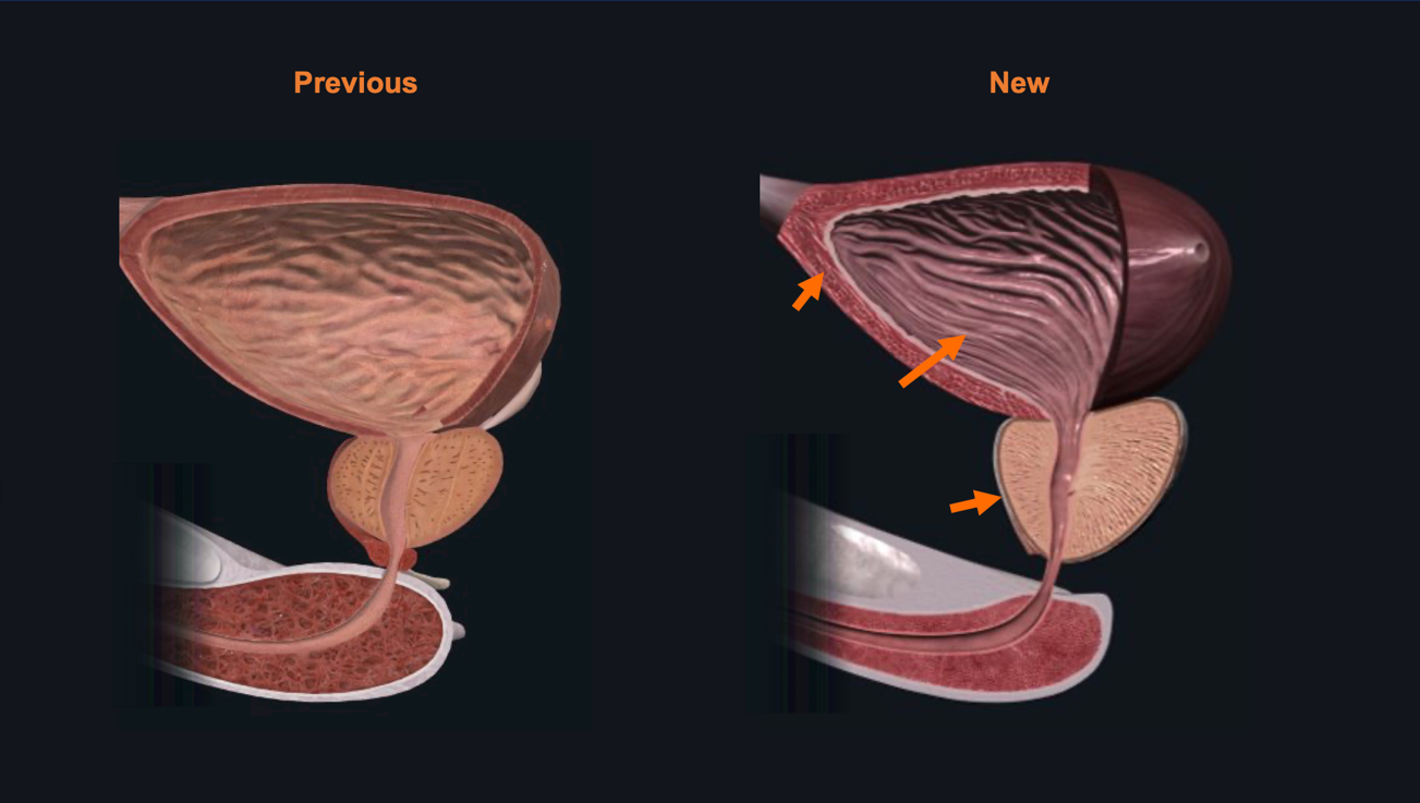 Side by side comparison of a sagittal view of the bladder, prostate, and urethra. Left has the previous model and on the right is the new model.